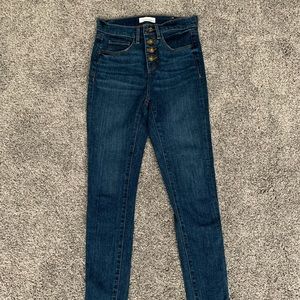 Women’s Loft Button-Up High Waist Jeans